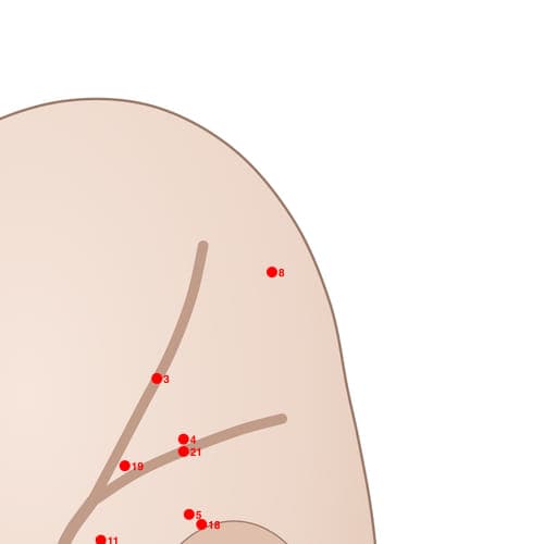 Location of acupuncture point POS08 (Upper Ear Root)