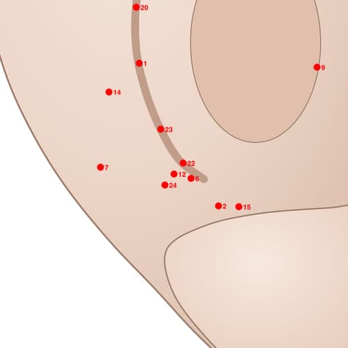 Location of acupuncture point POS12 (Triangle Area of Cervical Vertebra)