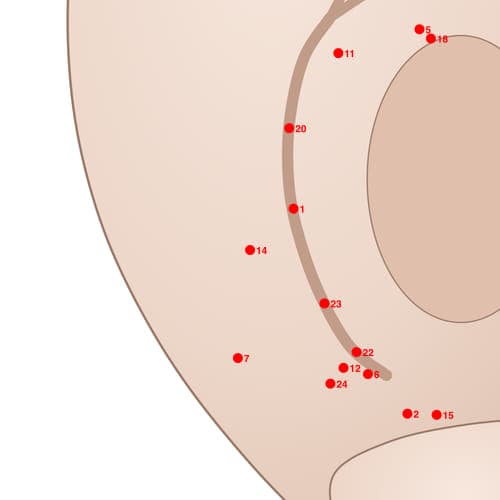 Location of acupuncture point POS14 (Three Shoulder Points)