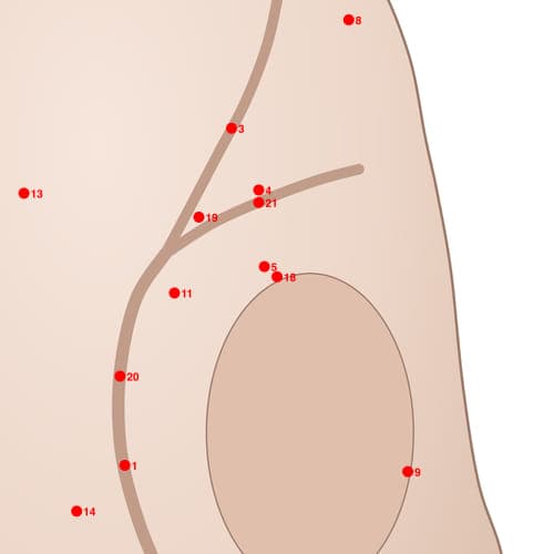 Location of acupuncture point POS18 (Duodenum Ball of Posterior)