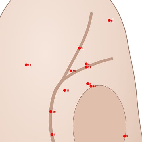 Location of acupuncture point POS19 (Popliteal Fossa Posterior)
