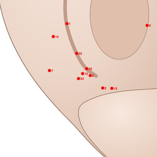 Location of acupuncture point POS24 (Large Auricular Nerve Posterior)
