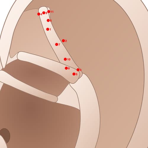 Location of acupuncture point SAC05 (Hip Joint)