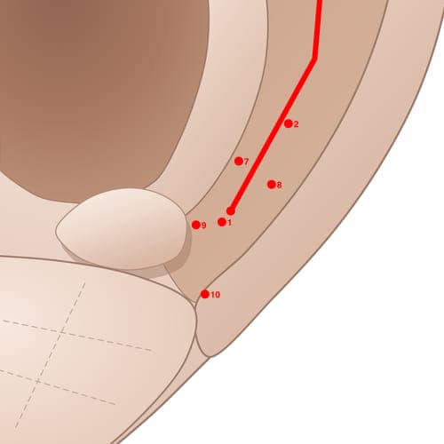 Location of acupuncture point SC01 (Clavicle)