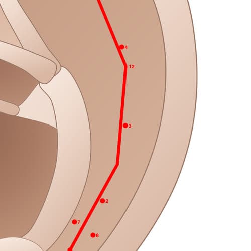 Location of acupuncture point SC03 Jian (Shoulder)