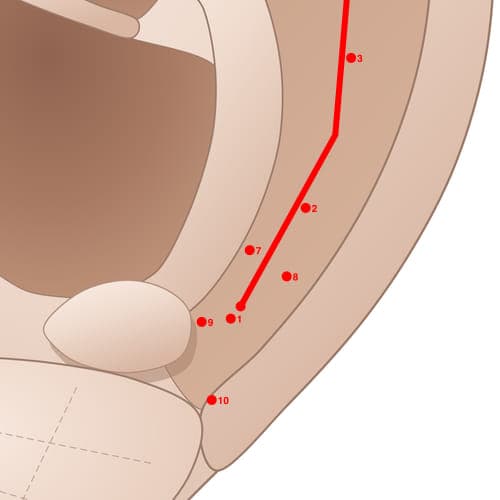 Location of acupuncture point SC07 (Arm Pit (Armpit))