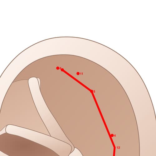 Location of acupuncture point SC11 (Allergic Area)