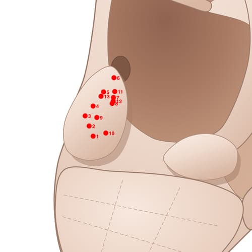 Location of acupuncture point TR02 (Hunger Point)