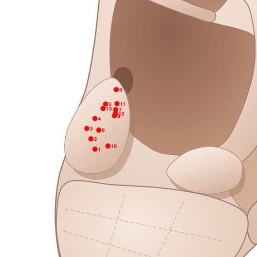 Location of acupuncture point TR03 (External Nose)