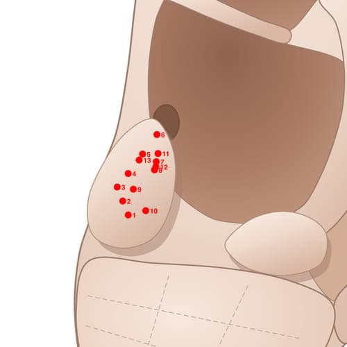 Location of acupuncture point TR04 Kedian (Thirst Point)