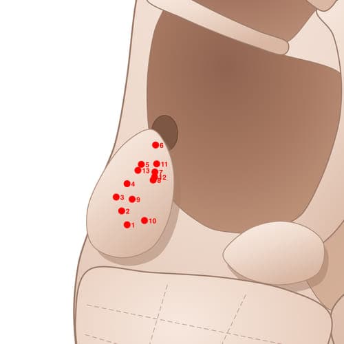 Location of acupuncture point TR07 (Larynx)