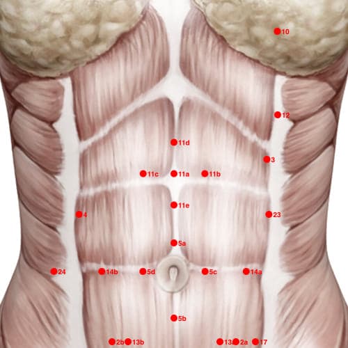 XC11A acupoint