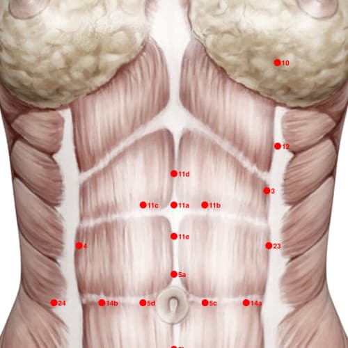 XC11D acupoint