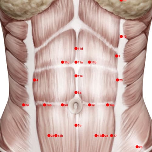 Location of acupuncture point XC11E (Plum Blossom)
