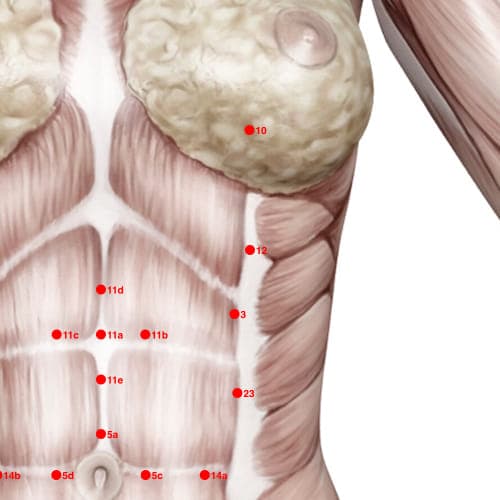 Location of acupuncture point XC12 Huangmu (Accumulation)
