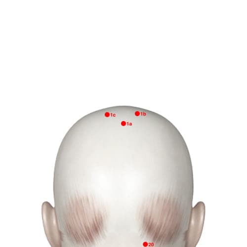 Extra Points: Head – location of XH01A