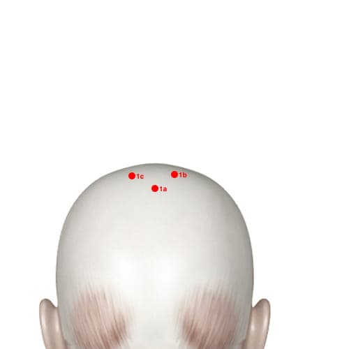 XH01B acupoint