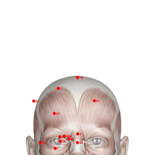 XH01D acupoint