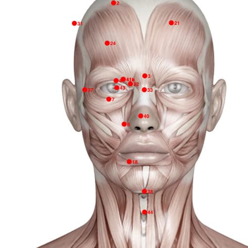 Location of acupuncture point XH08 (Nose Passage)