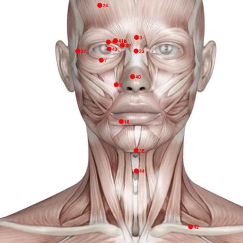 Location of acupuncture point XH18 (Lower Saliva Receptacle)