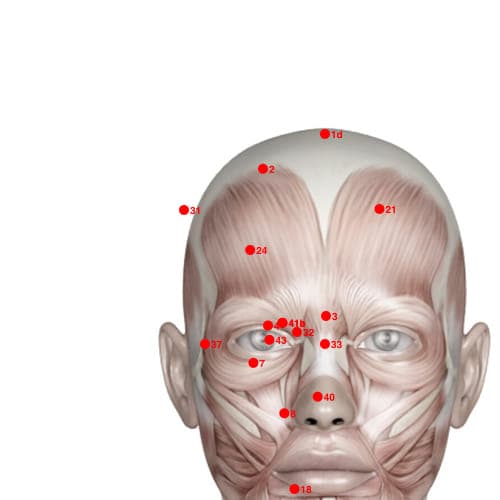 Location of acupuncture point XH24 (New Brightness)
