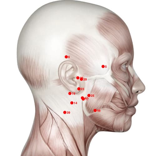 XH30 acupoint