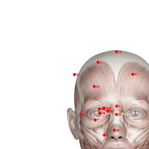Location of acupuncture point XH31 (Hairline)