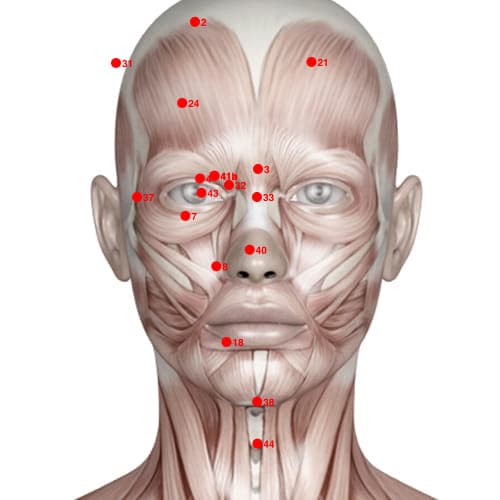 Location of acupuncture point XH40 (Nose Eyes)