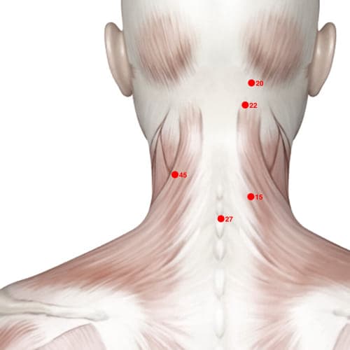 Location of acupuncture point XH45 (New Beginning)