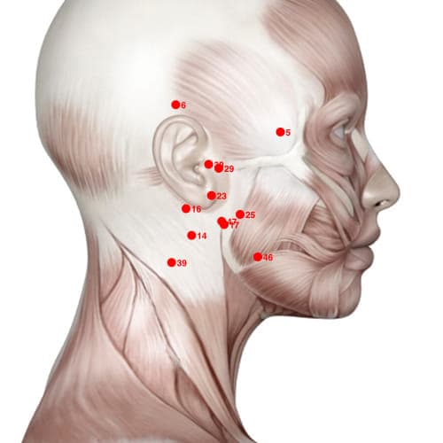 Location of acupuncture point XH47 (Inside Fire)