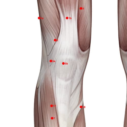 Location of acupuncture point XL05B (Eyes Of The Knee)