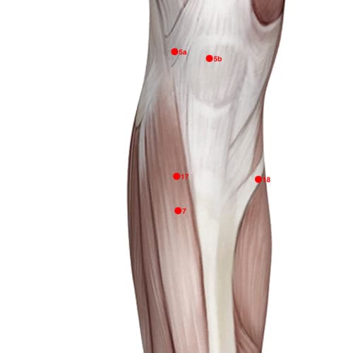 Location of acupuncture point XL17 (Middle Calm)