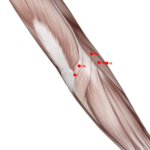 Extra Points: Upper limbs – location of XU01
