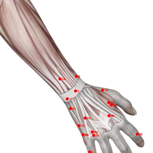 Location of acupuncture point XU08 (Outer Labour Palace / Pillow Fall (Stiff Neck))