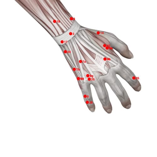 XU09H acupoint