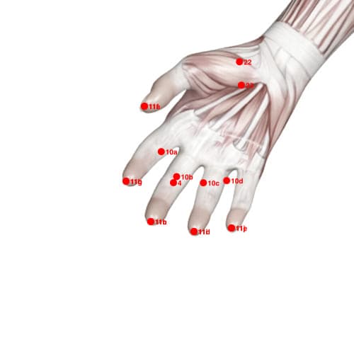Location of acupuncture point XU10B (Four Stitches)