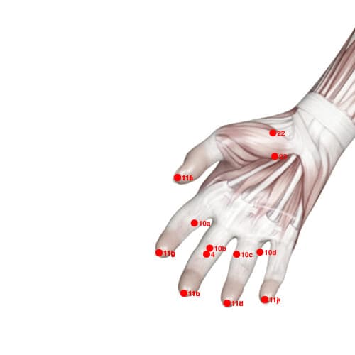 Location of acupuncture point XU11A (Ten Diffusions)