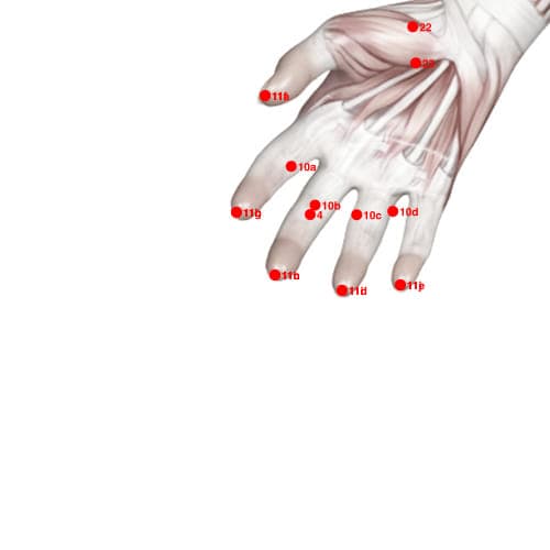 XU11H acupoint