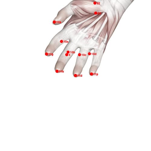 Location of acupuncture point XU11I (Ten Diffusions)