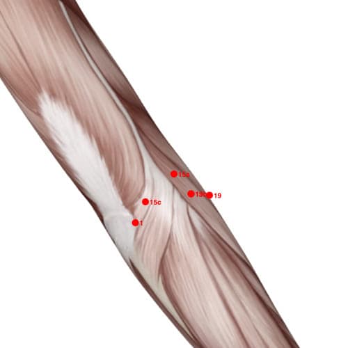 XU15A acupoint