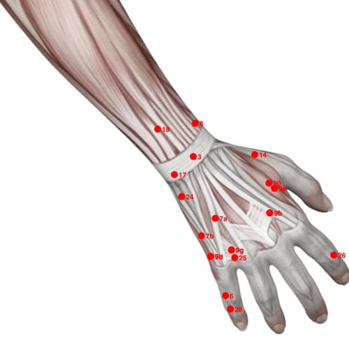 Location of acupuncture point XU17 (Urine Control)