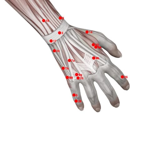 XU25 acupoint
