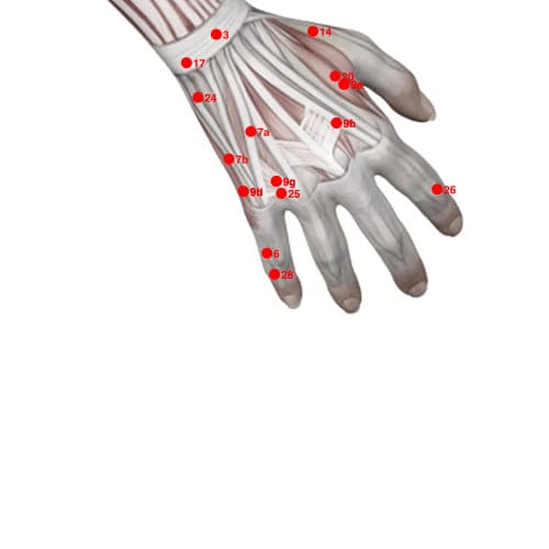XU28 acupoint