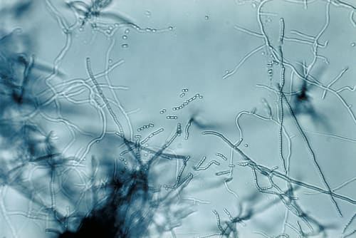 Streptomyces, standing in for Streptomyces globisporus