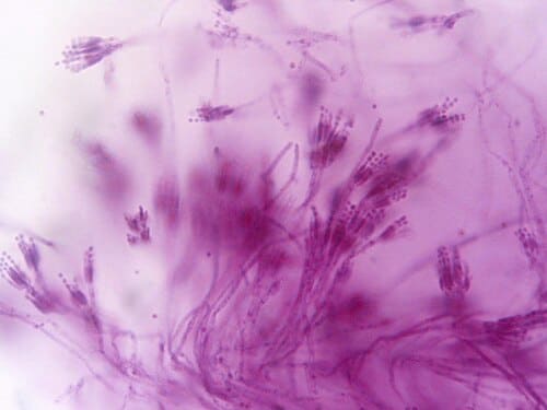 Penicillium, standing in for Penicillium loutianum