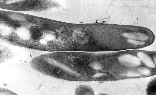 Mycobacterium, standing in for Mycobacterium phlei