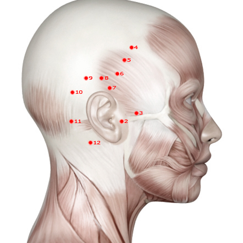 GB02 Acupuncture Point - Gallbladder Meridian Meridian - Hearing Convergence - Muscular view