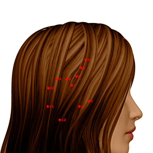 GB06 Acupuncture Point - Gallbladder Meridian Meridian - Suspended Tuft - Dermal view