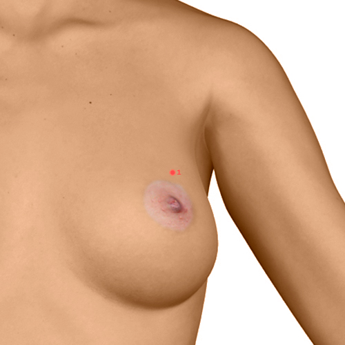 PC01 Acupuncture Point - Pericardium Meridian Meridian - Heavenly Pool - Dermal view