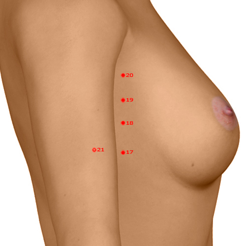 SP18 Acupuncture Point - Spleen Meridian Meridian - Celestial Cleft - Dermal view